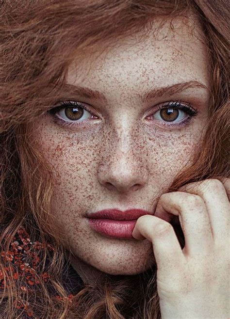 nude freckled girls|98 Freckled People Who’ll Hypnotize You With Their Unique Beauty